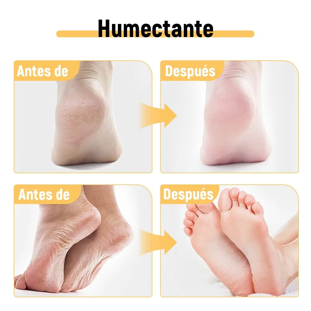 Smooth Steps Foot Therapy Balm, 2025 Upgraded Hydrating and Anti-Cracking Foot Cream, Foot Cream for Dry Cracked Heels and Feet Women Men Travel (Honey, Standard)